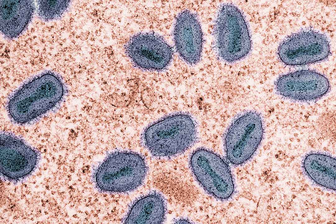 Mpox virus colorised transmission electron micrograph of mpox virus particles (purple and teal) found within an infected cell (brown), cultured in the laboratory. Photo by National Institute of Allergy and Infectious Diseases on Unsplash