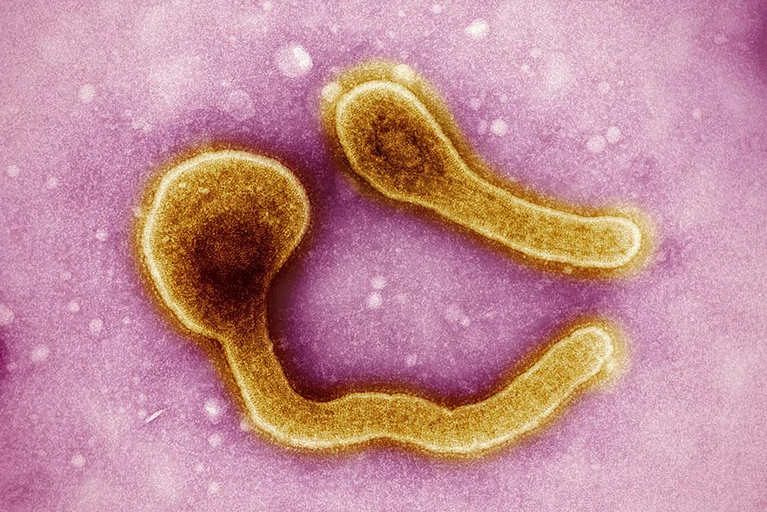 Marburg virus particles colourised. Photo by National Institute of Allergy and Infectious Diseases on Unsplash